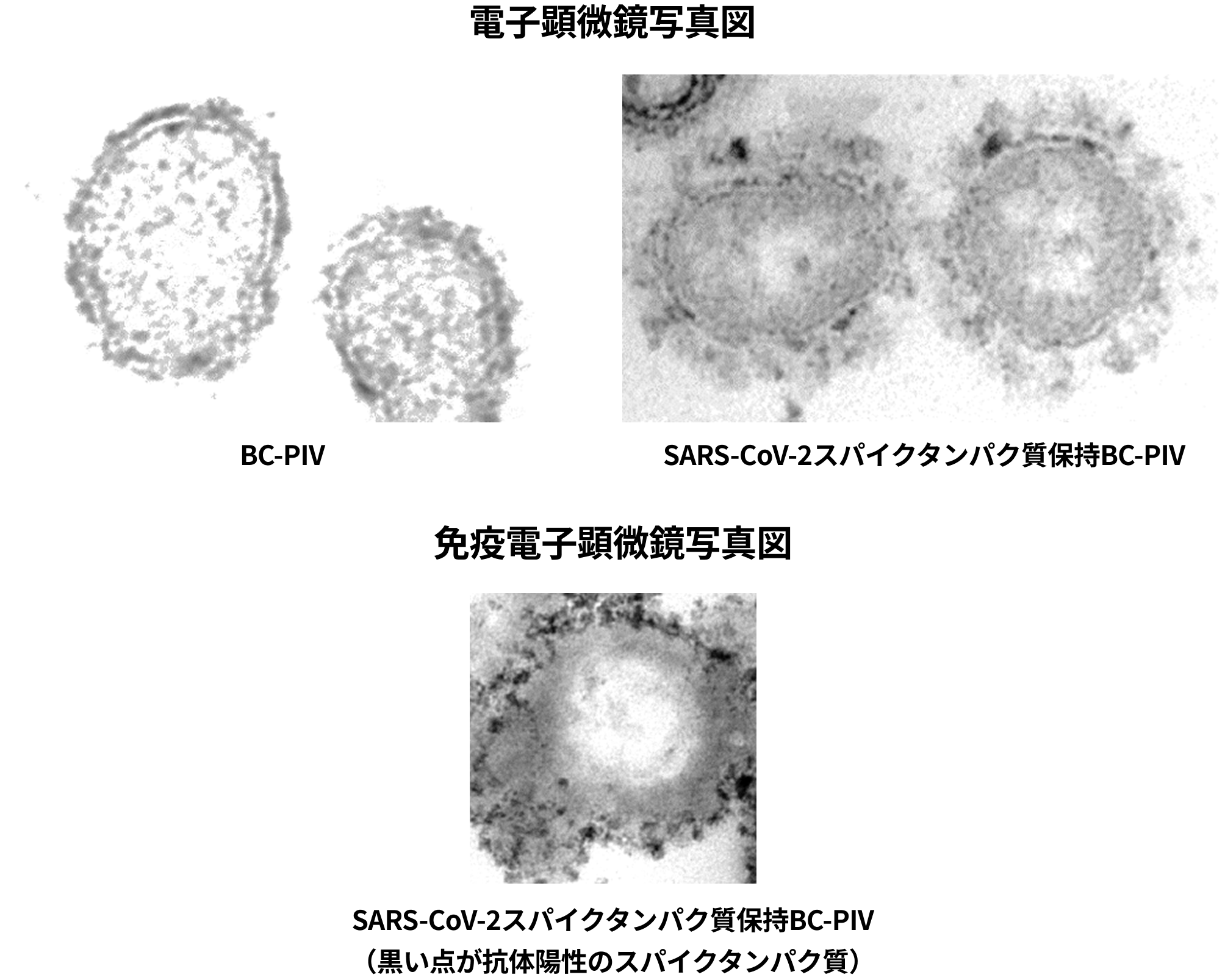 電子顕微鏡写真図/免疫電子顕微鏡写真図